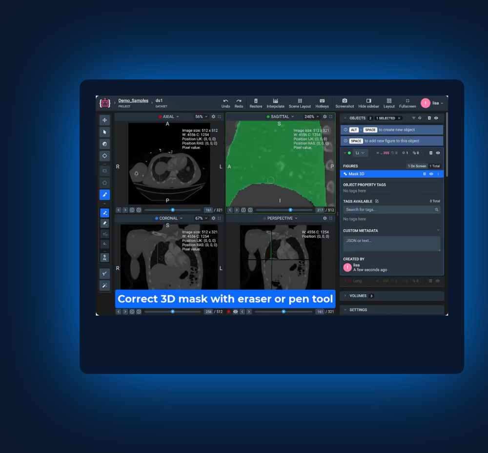 Medical Image Labeling mockup